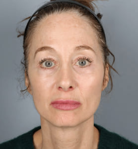 Dummy Image